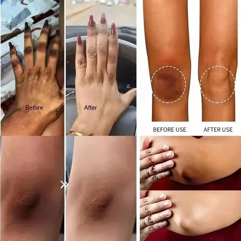 Body Whitening Cream Donkere huid