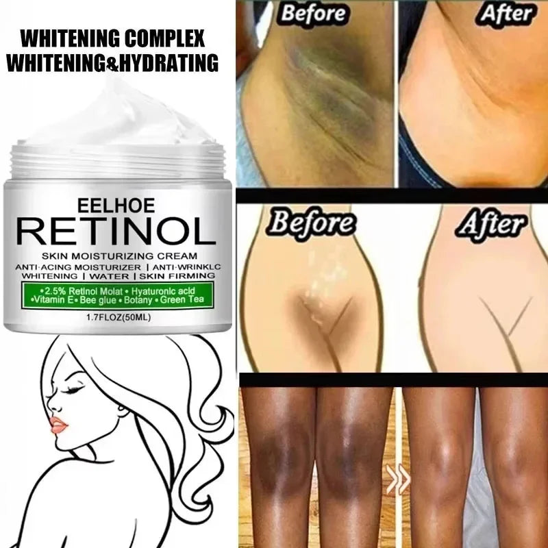 Body Whitening Cream Donkere huid